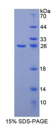Figure 1. SDS-PAGE