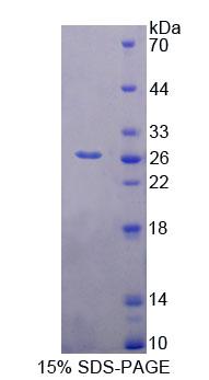 Figure 1. SDS-PAGE
