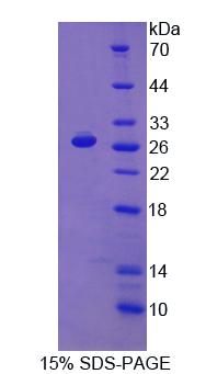 Figure 1. SDS-PAGE