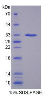 Figure 1. SDS-PAGE