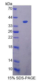 Figure 1. SDS-PAGE