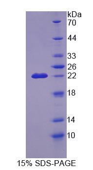 Figure 1. SDS-PAGE