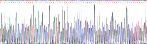 Recombinant Human Superoxide Dismutase 3, Extracellular (SOD3)