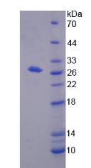 Figure 2. SDS-PAGE
