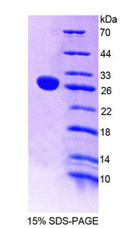 Figure 1. SDS-PAGE