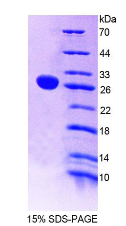 Figure 1. SDS-PAGE