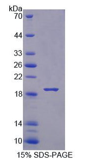 Figure 1. SDS-PAGE