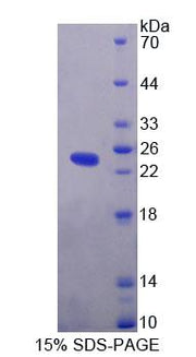 Figure 1. SDS-PAGE