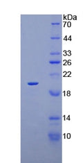 Figure 2. SDS-PAGE