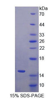 Figure 1. SDS-PAGE