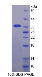 Figure 1. SDS-PAGE