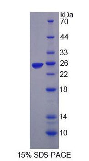 Figure 1. SDS-PAGE