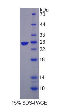Figure 1. SDS-PAGE