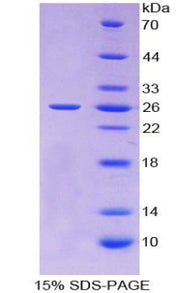 Figure 1. SDS-PAGE