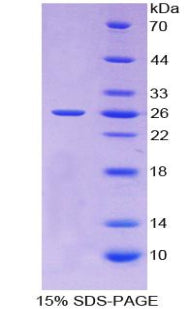 Figure 1. SDS-PAGE