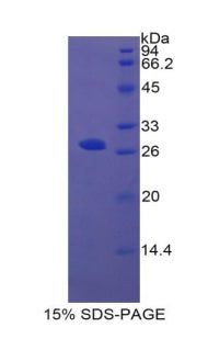 Figure 1. SDS-PAGE