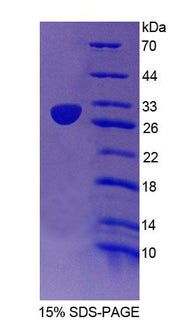 Figure 1. SDS-PAGE