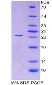 Figure 1. SDS-PAGE