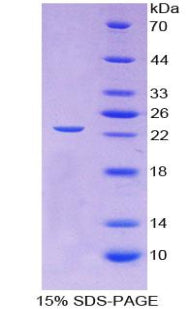 Figure 1. SDS-PAGE