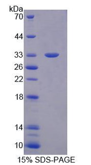 Figure 1. SDS-PAGE