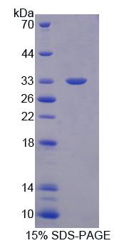 Figure 1. SDS-PAGE