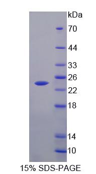 Figure 1. SDS-PAGE
