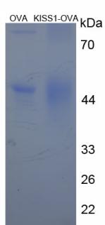 OVA Conjugated Human Kisspeptin 1 (KISS1)