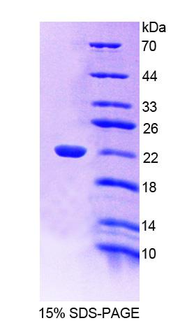 Figure 1. SDS-PAGE