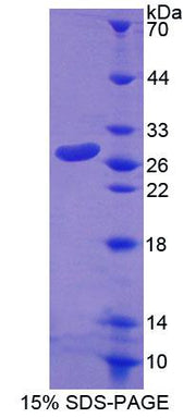 Figure 1. SDS-PAGE