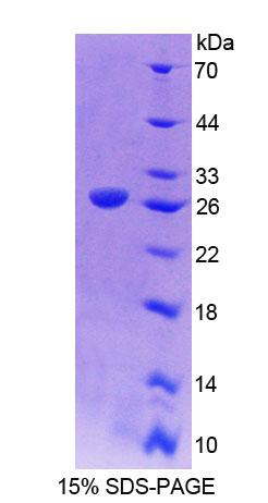 Figure 1. SDS-PAGE
