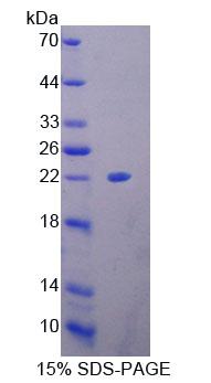 Figure 1. SDS-PAGE