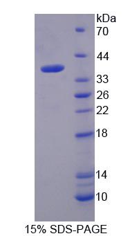 Figure 1. SDS-PAGE