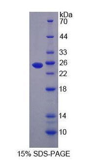 Figure 1. SDS-PAGE