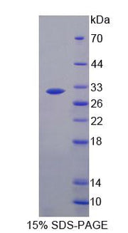Figure 1. SDS-PAGE