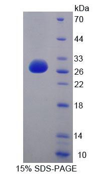 Figure 1. SDS-PAGE