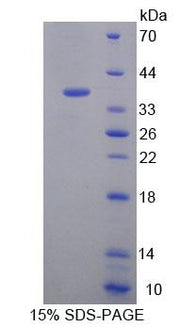 Figure 1. SDS-PAGE
