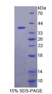 Figure 1. SDS-PAGE