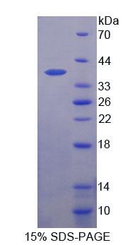 Figure 1. SDS-PAGE