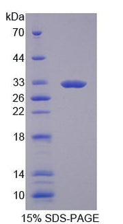 Figure 1. SDS-PAGE