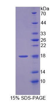 Figure 1. SDS-PAGE