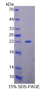 Figure 1. SDS-PAGE
