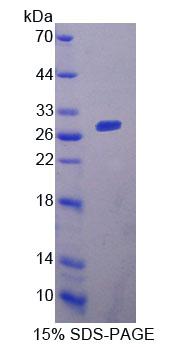 Figure 1. SDS-PAGE