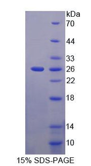 Figure 1. SDS-PAGE