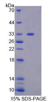 Figure 1. SDS-PAGE