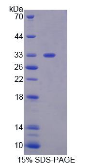 Figure 1. SDS-PAGE