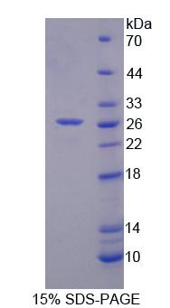 Figure 1. SDS-PAGE