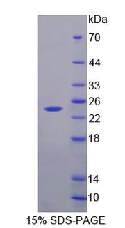 Figure 1. SDS-PAGE
