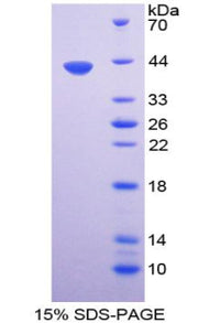 Figure 1. SDS-PAGE