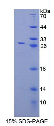 Figure 1. SDS-PAGE