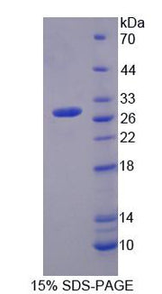 Figure 1. SDS-PAGE
